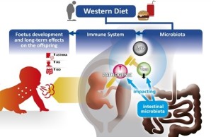 Hypothetical impact of western diet on immune system and foetal and offspring's development