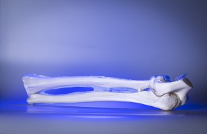  Bild eines 3D gedruckten Ellenbogenknochens