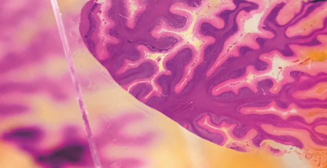 durch ein Mikroskop vergrößerter Schnitt eines Kleinhirngewebes, es ist auf einem Glasträger aufgebracht und lila eingefärbt