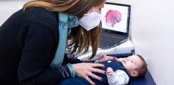 3D-Druck bei Babies mit angeborenen Gaumensplate