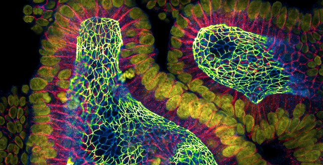Mikroskop-Ansicht: Organoide ermöglichen eine einzigartige Modellierung von Erkrankungen