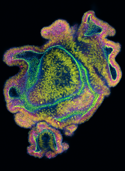 Immunfluoreszenzbild zweier Organoide des Darms
