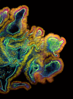 Immunfluoreszenzbild zweier Organoide des Darms