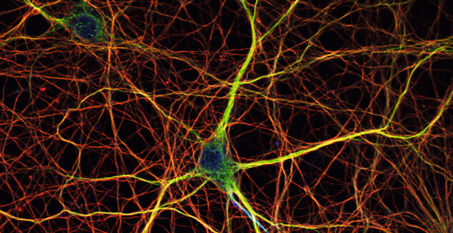 Eingefärbte Nervenzellen des Gehirns: Mikrotubuli (rot, grün und gelb) bilden das Gerüst der Zellen. Das Tau-Protein bindet an Mikrotubuli in bestimmten Zell-Fortsätzen, den Axonen (blau)