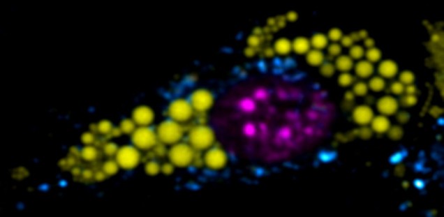 Organelles stained in a brown adipocyte (lysosomes in cyan, lipid droplets in yellow, nucleus in magenta).