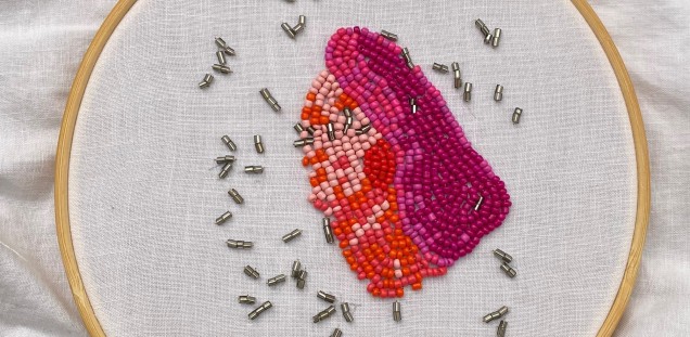 Stickbild von Bakterien aus Perlen in einer Nährlösung