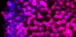 Podosomes in a human macrophage (F-actin in blue, vinculin in magenta)