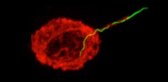 Photo/ Macrophage capturing Borrelia spirochete (F-actin in red, GFP in green) ©AG Linder