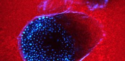 Photo/ Matrix degradation by podosomes (gelatin matrix in red, F-actin in blue) ©AG Linder
