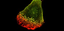 Photo Podosomes in a human marcrophage (F-actin in red, supervillin in green) ©AG Linder
