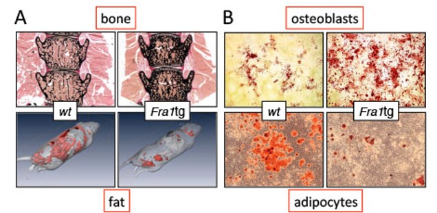Figure 1 Example of co-regulation of fat and bone by AP-1