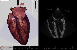 Simulation Herz