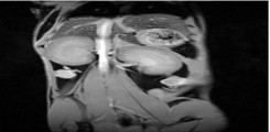T1-gewichtetes koronales MR-Bild des Abdomens einer Maus. Sichtbar sind die inneren Organe wie Leber und Nieren.