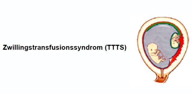 TTTS-Logo