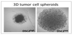 Tumor cell spheroids