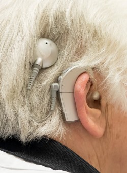 Cochlea-Implantat-Versorgung professionell im UKE