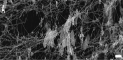 Elektronen-mikroskopische Aufnahme von Bakterien in NETs.