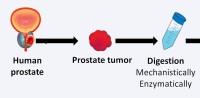 Development of patient-derived xenograft models (PDX) of metastatic prostate cancer