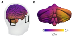 Das cerebello-thalamo-kortikale Netzwerk bei der Dystonie