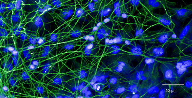 Aus humanen iPS-Zellen generierte Nervenzellen, hier grün gefärbt. Blau zeigt die Zellkerne.