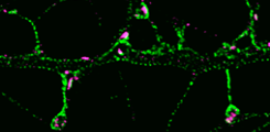 STED image of hippocampal neuron