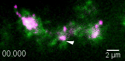 Bewegliche Myosin Cargos (recycling endosomes) in Purkinjezellen